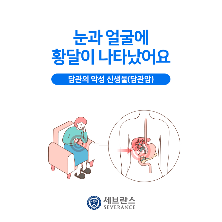 눈과 얼굴에 황달이 나타났어요 - 담관암