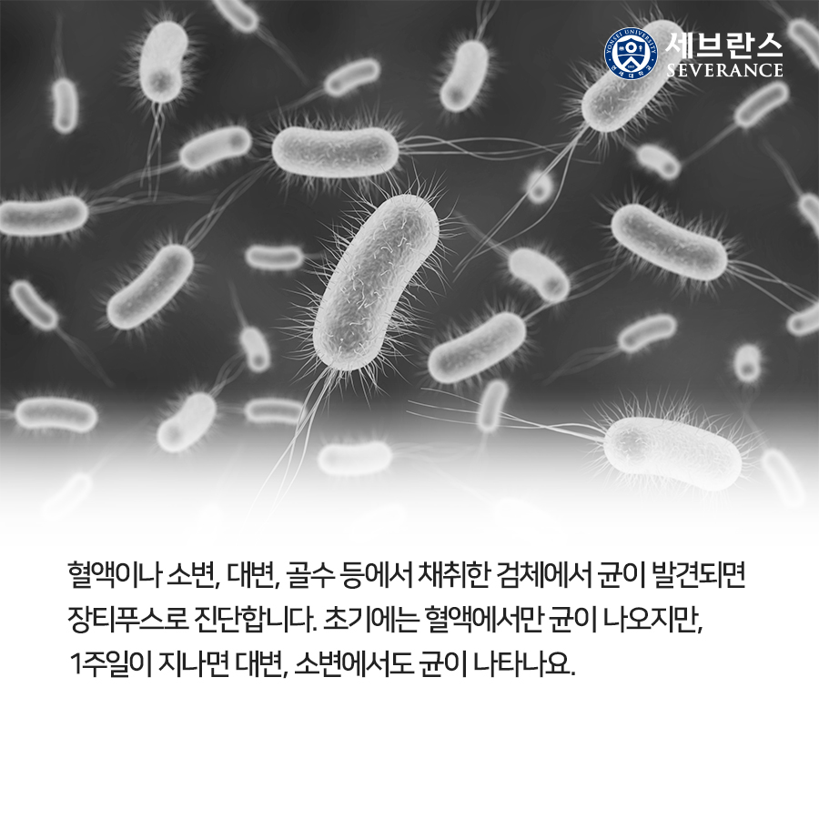 혈액이나 소변, 대변, 골수 등에서 채취한 검체에서 균이 발견되면  장티푸스로 진단합니다. 초기에는 혈액에서만 균이 나오지만,  1주일이 지나면 대변, 소변에서도 균이 나타나요. 